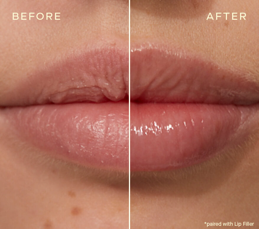 Ourself Lip Plumping & Enhancing Duo Kit