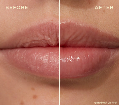 Ourself Lip Plumping & Enhancing Duo Kit